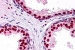 DDX5 Antibody in Immunohistochemistry (Paraffin) (IHC (P))