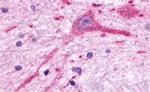 MCHR2 Antibody in Immunohistochemistry (Paraffin) (IHC (P))