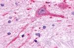 MCHR2 Antibody in Immunohistochemistry (Paraffin) (IHC (P))