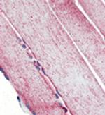 SOD2 Antibody in Immunohistochemistry (IHC)