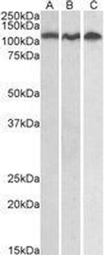 ADAM17 Antibody in Western Blot (WB)