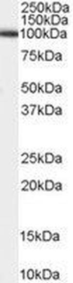 ADAM17 Antibody in Western Blot (WB)