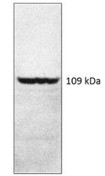 PDE4A Antibody in Western Blot (WB)