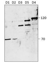 PDE4D Antibody in Western Blot (WB)