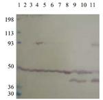 PDE10A Antibody in Western Blot (WB)