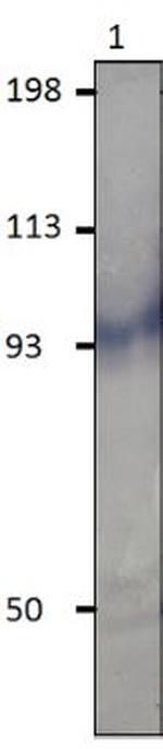 PDE11A Antibody in Western Blot (WB)