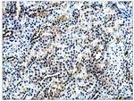 AMACR Antibody in Immunohistochemistry (Paraffin) (IHC (P))