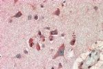 FBXL2 Antibody in Immunohistochemistry (Paraffin) (IHC (P))