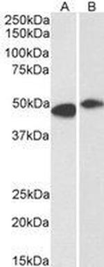 FBXL2 Antibody in Western Blot (WB)