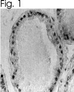 Estrogen Receptor beta Antibody in Immunohistochemistry (IHC)