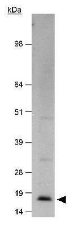 p14ARF Antibody in Western Blot (WB)