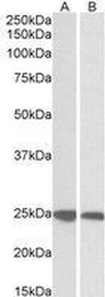 GRB2 Antibody in Western Blot (WB)