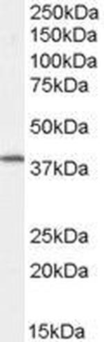 Dysadherin Antibody in Western Blot (WB)