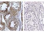 DNMT3L Antibody in Immunohistochemistry (IHC)