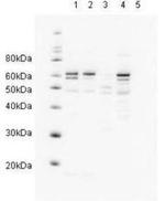 RAD23A Antibody in Western Blot (WB)