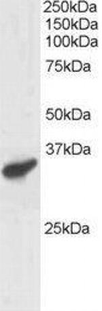 RNF3 Antibody in Western Blot (WB)