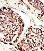 ErbB3 Antibody in Immunohistochemistry (Paraffin) (IHC (P))