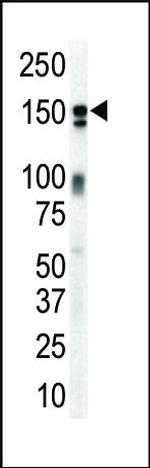 ErbB3 Antibody in Western Blot (WB)