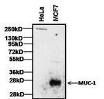 Armenian Hamster IgG (H+L) Secondary Antibody in Western Blot (WB)