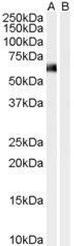 Syntrophin alpha-1 Antibody in Western Blot (WB)