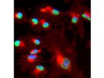 BMI-1 Antibody in Immunocytochemistry (ICC/IF)