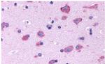 HTR2B Antibody in Immunohistochemistry (Paraffin) (IHC (P))