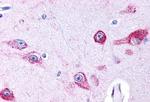 HTR2B Antibody in Immunohistochemistry (Paraffin) (IHC (P))