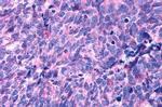 HTR2B Antibody in Immunohistochemistry (Paraffin) (IHC (P))