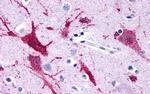 GPR116 Antibody in Immunohistochemistry (Paraffin) (IHC (P))