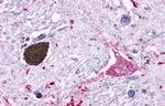 GPR116 Antibody in Immunohistochemistry (Paraffin) (IHC (P))