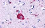 GPR116 Antibody in Immunohistochemistry (Paraffin) (IHC (P))