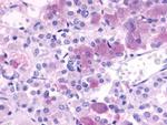 NPBWR1 Antibody in Immunohistochemistry (Paraffin) (IHC (P))