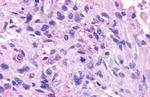 NPBWR1 Antibody in Immunohistochemistry (Paraffin) (IHC (P))