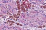 NPBWR1 Antibody in Immunohistochemistry (Paraffin) (IHC (P))