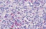 GPR109B Antibody in Immunohistochemistry (Paraffin) (IHC (P))