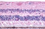 MTNR1B Antibody in Immunohistochemistry (Paraffin) (IHC (P))