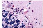 MTNR1B Antibody in Immunohistochemistry (Paraffin) (IHC (P))