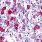 GPR161 Antibody in Immunohistochemistry (Paraffin) (IHC (P))