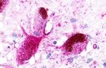 NMUR1 Antibody in Immunohistochemistry (Paraffin) (IHC (P))