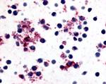 PTGIR Antibody in Immunohistochemistry (Paraffin) (IHC (P))