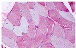 FZD6 Antibody in Immunohistochemistry (Paraffin) (IHC (P))