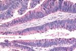 FZD7 Antibody in Immunohistochemistry (Paraffin) (IHC (P))