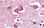 NPBWR2 Antibody in Immunohistochemistry (Paraffin) (IHC (P))