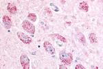 NPBWR2 Antibody in Immunohistochemistry (Paraffin) (IHC (P))