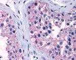 TAS1R1 Antibody in Immunohistochemistry (Paraffin) (IHC (P))