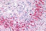 GPR133 Antibody in Immunohistochemistry (Paraffin) (IHC (P))