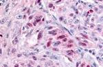 NR1D1 Antibody in Immunohistochemistry (Paraffin) (IHC (P))