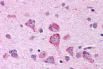 OXGR1 Antibody in Immunohistochemistry (Paraffin) (IHC (P))