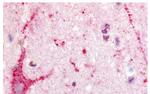 EDG8 Antibody in Immunohistochemistry (Paraffin) (IHC (P))