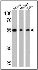 LXR beta Antibody in Western Blot (WB)